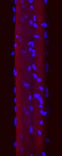 Confocal microscopy showing myonuclei (blue) in an individual muscle fibre (red)