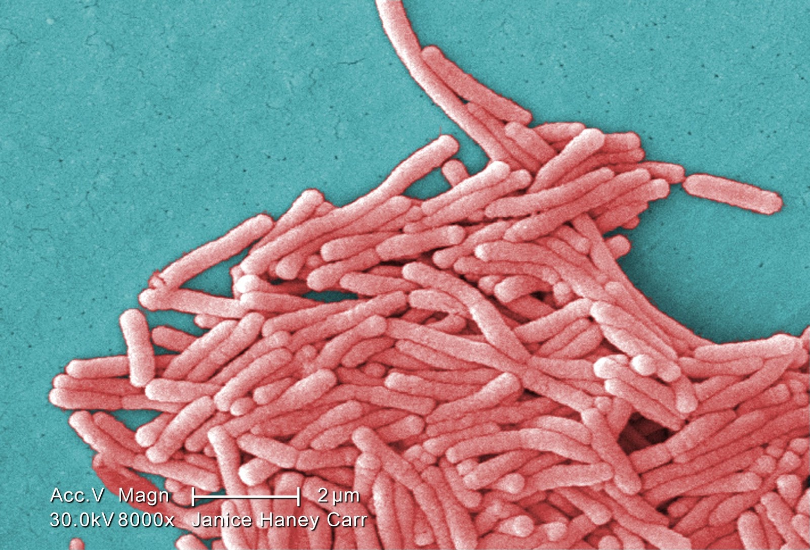 Legionella_pneumophila_(SEM)