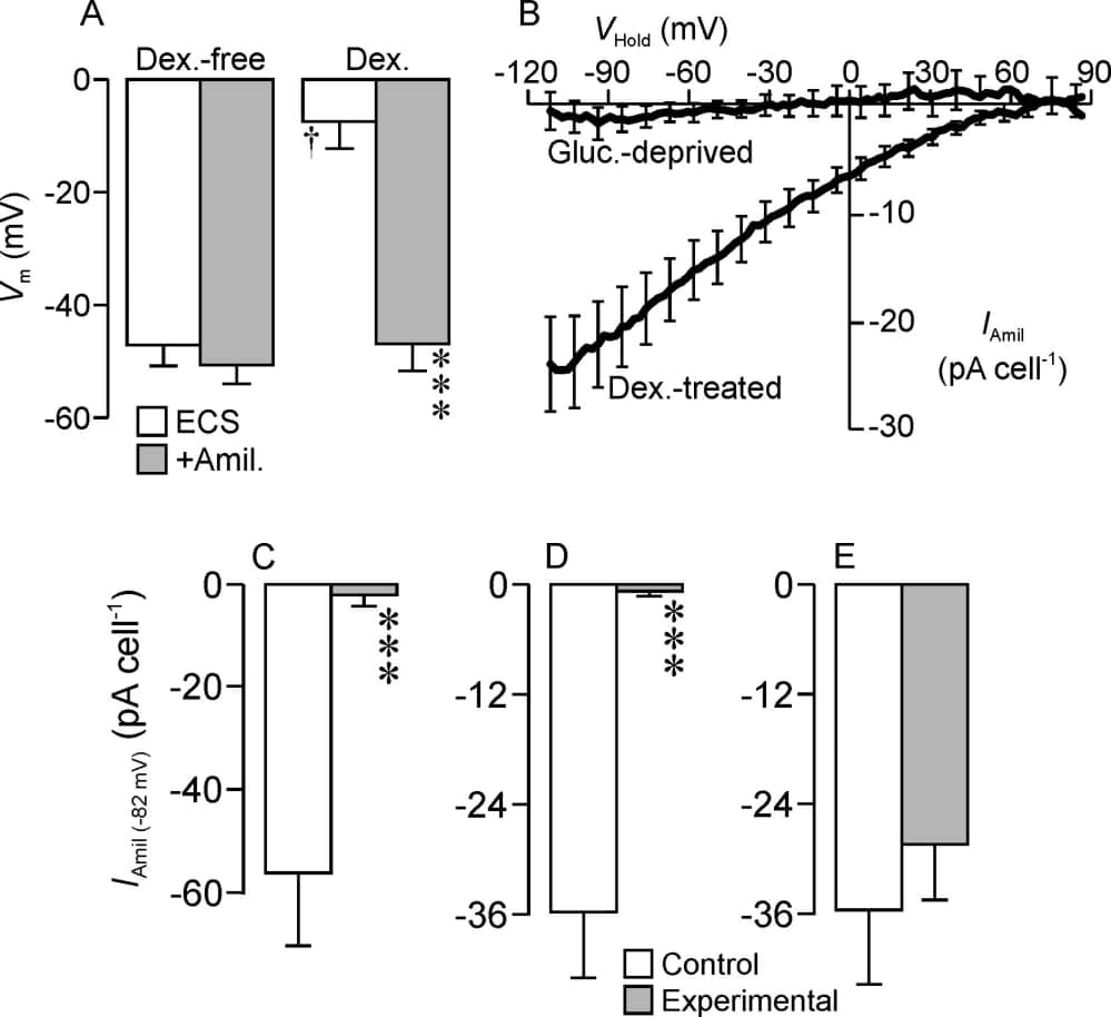 Figure 1. Membrane currents evoked by ramp changes in holding potential (VHold) were recorded in the perforated patch configuration during exposure to standard extracellular saline (ECS) and during exposure to 10 µM amiloride (+Amil). (A) Effects of amiloride upon Vm in glucocorticoid-deprived and dexamethasone-treated (0.2 µM, ~24 h) cells. (B) Effects of dexamethasone (0.2 µM, ~24 h) upon the amiloride-sensitive component of the membrane current (IAmil). The amiloride sensitive current flowing at -82 mV (IAmil(-82 mV)) was quantified in dexamethasone-treated (0.2 µM, ~24 h) control cells and in cells exposed (3 h) to 0.1 µM TORIN1 (C), 10 µM GSK650394) (D) or 0.1 µM rapamycin (E). All data are mean ± s.e.m and n > 4. Asterixes denote significant differences between control and experimental data (P < 0.001, Student’s paired t test), the dagger denotes a statistically significant effect of dexamethasone (P< 0.05, ANOVA).