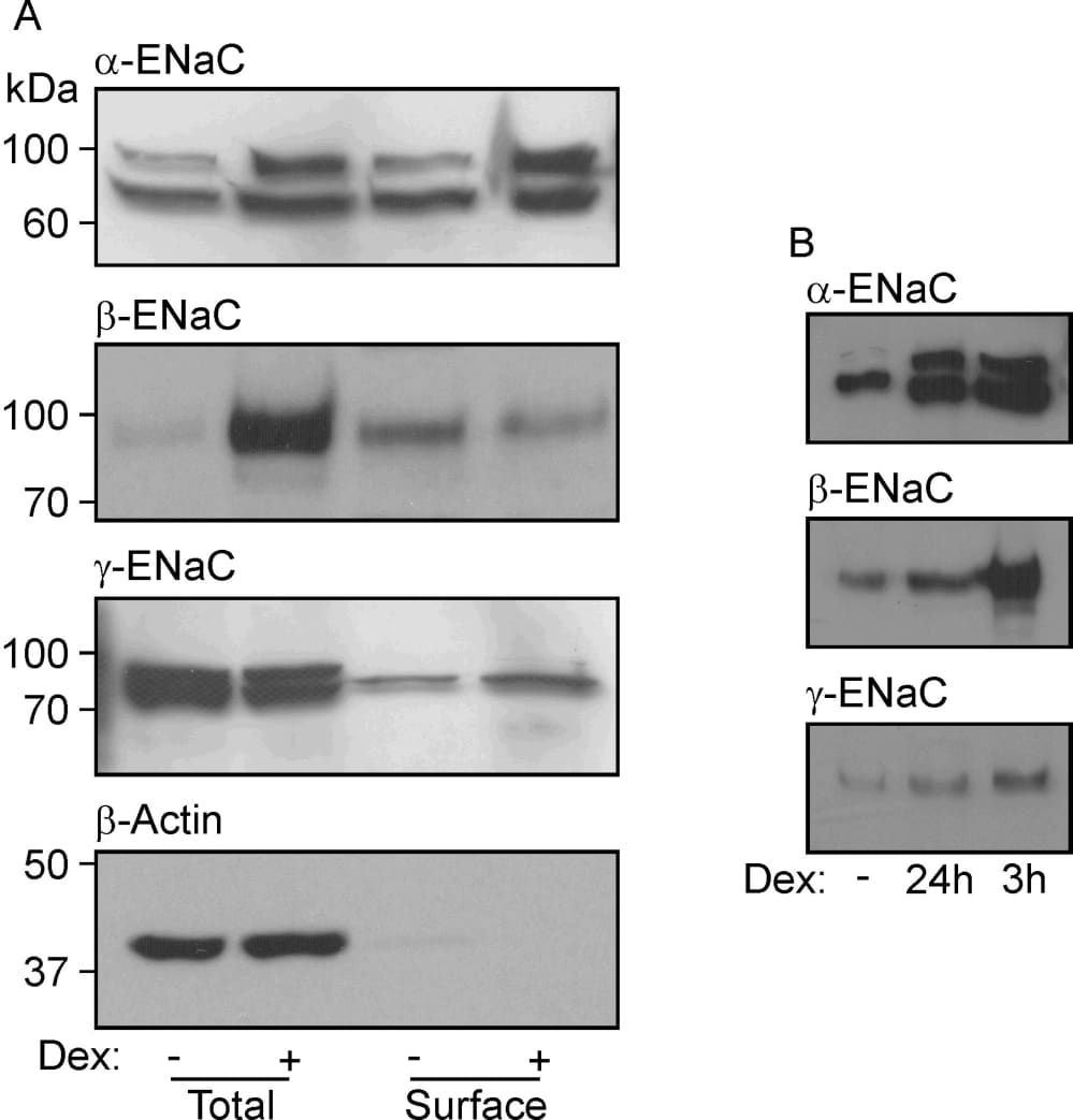 Figure 1. (A) Western blots showing the abundances of α-, β- and γ-ENaC and β-actin in total and surface-exposed proteins extracted from cells that had maintained (24 h) in hormone-free medium or in medium containing 0.2 µM dexamethasone. The lack of β–actin from the surface pool confirms that this protein preparation is essentially devoid of intracellular proteins. Essentially identical results were obtained in 5 experiments. (B) Abundances of α-, β- and γ-ENaC in surface exposed proteins isolated from glucocorticoid-deprived cells and from cells at identical passage that had been exposed to 0.2 µM dexamethasone for 3 h or 24 h (n = 3).