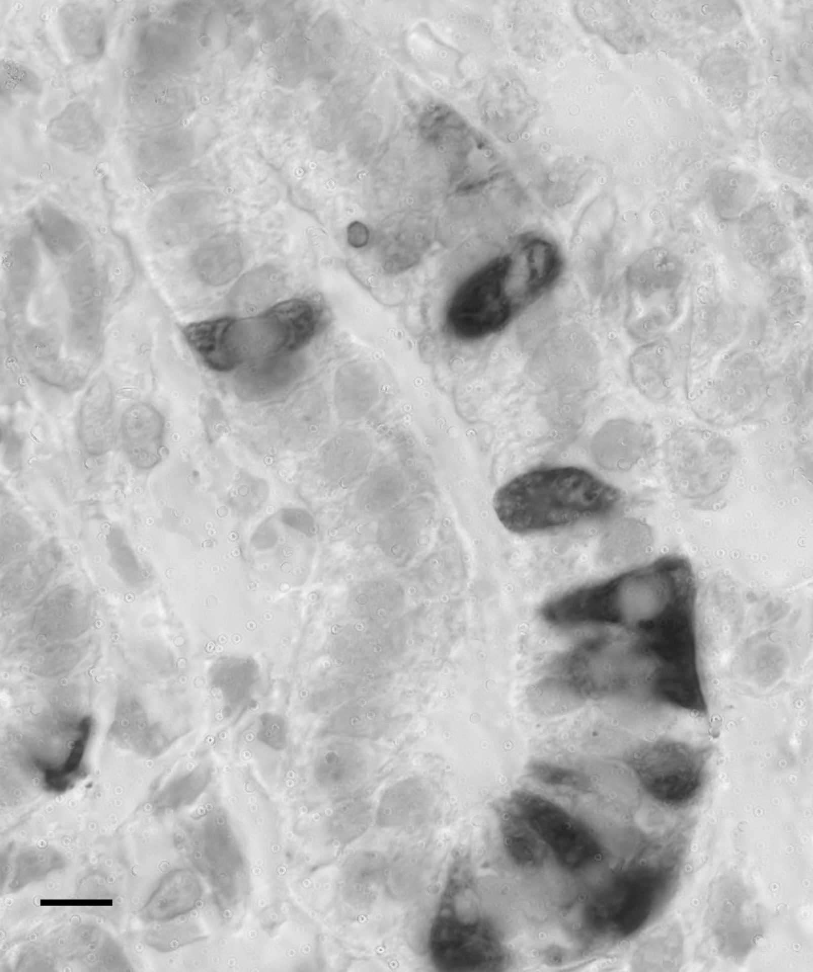 Figure 1. Immunolocalisation of UT protein in the collecting tubule of E19 SD rat metanephros. Note UT is not expressed in every cell of collecting tubule, and the intensity and distribution of cellular expression varies between cells. Scale bar 20Î¼m.