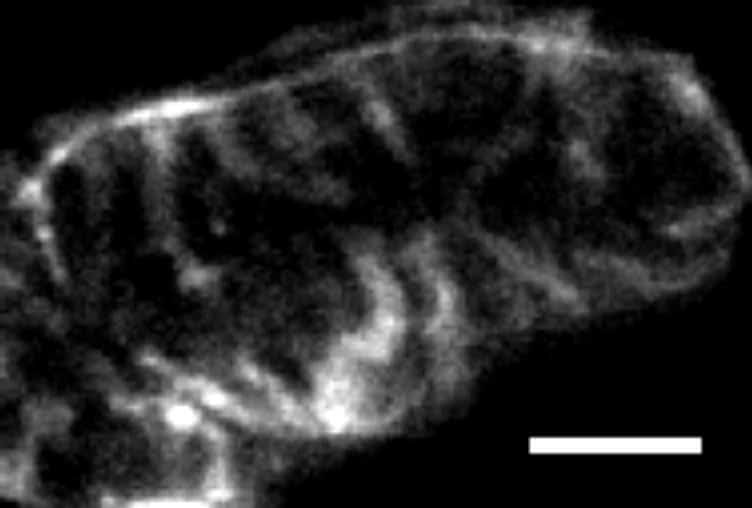 Figure 1. Confocal image of Di-4-ANEPPS stained rabbit ventricular myocyte orientated end on in a microfabricated structure. (Scale bar = 5 µm).