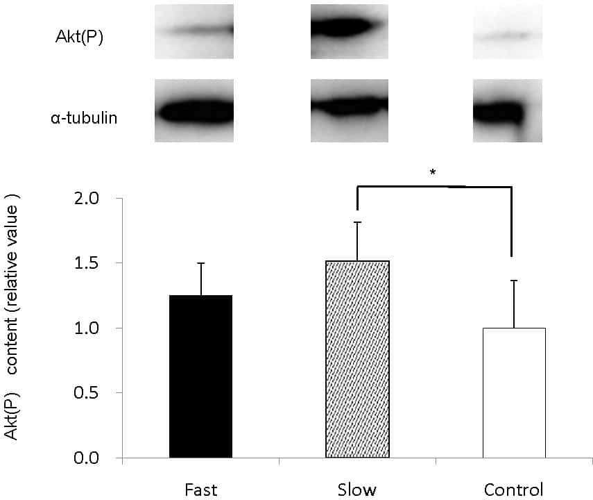 Fig. 2. Muscle contents of FOXO1(P)
