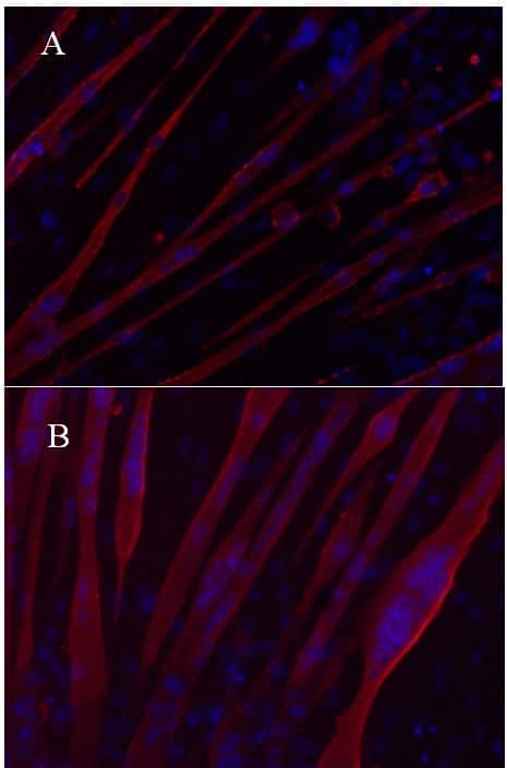 Fig.1. EPA protects against the deleterious effects of TWEAK on differentiated myotubes. Myotubes differentiated for 96h were incubated for a further 72h in DM in the presence of several EPA (50µM) and TWEAK (10ng/ml) treatments , (A) TWEAK only (B) 2 hr EPA pre treatment followed by TWEAK alone.