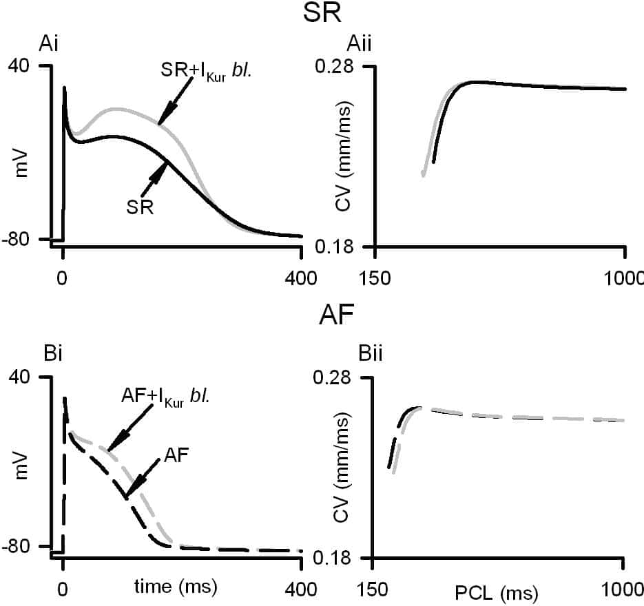 Figure 1. Effects of IKur block on SR cell APs (Ai) and 1D strand CVr (Aii) (solid line: Control; gray line: IKur block). Effects of IKur block in AF-remodelled cell APs (Bi) and 1D strand CVr (Bii) (solid line: Control; gray line: IKur block).
