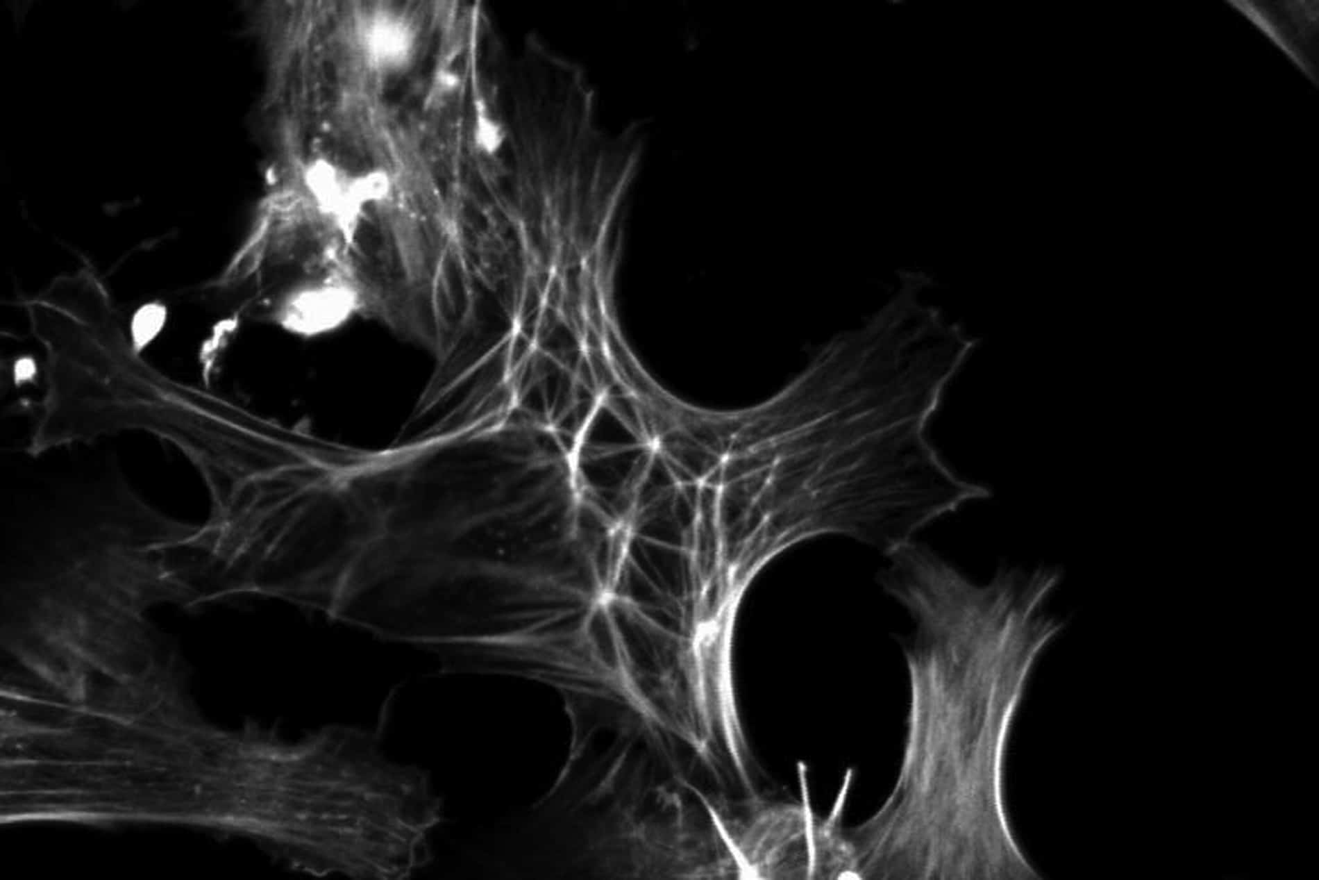 CLAN in Trabecular meshwork cell imaged by confocal microspcopy. The usual arrangemnt of F-actin is that of stress fibres of varying length.