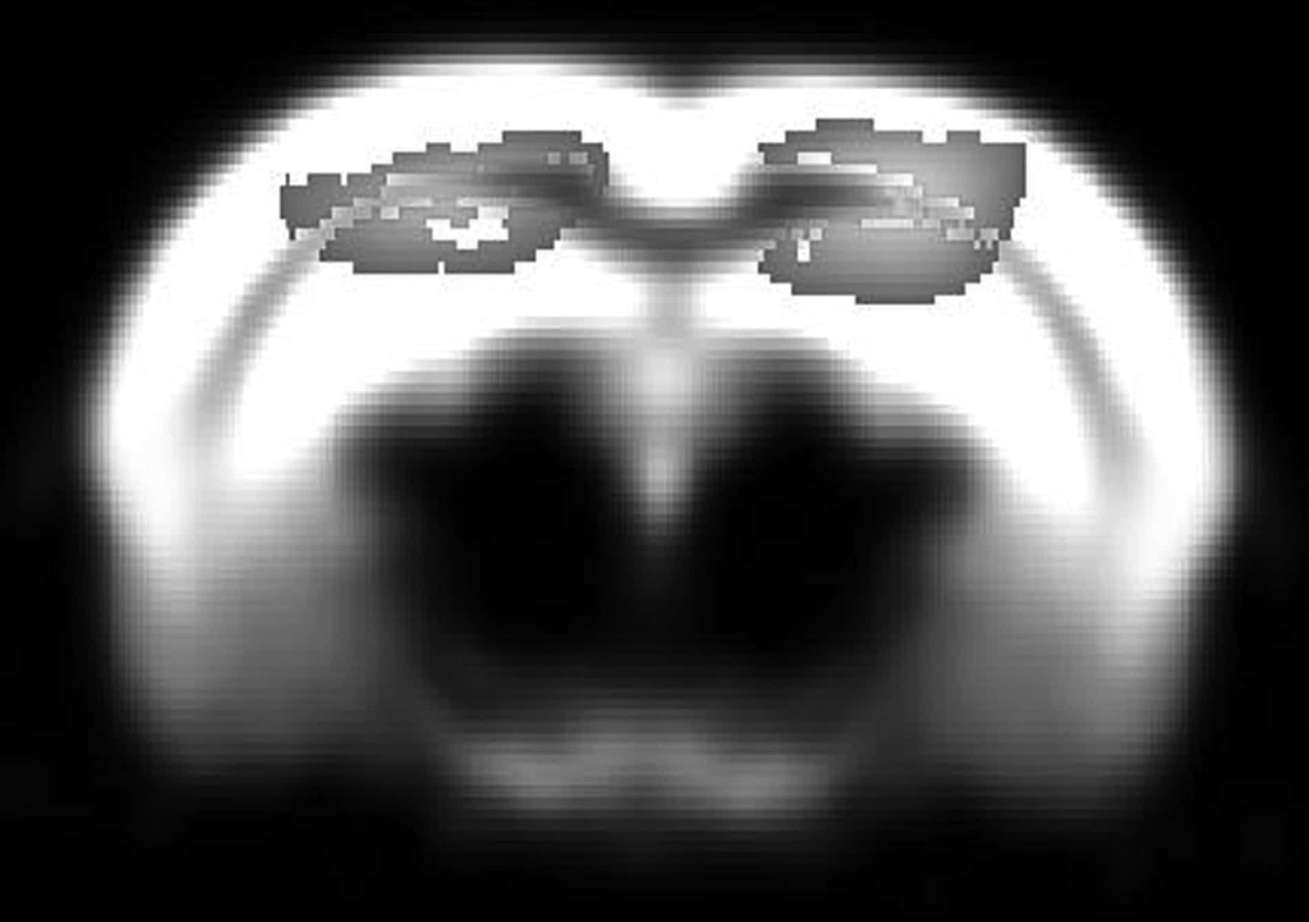 Coronal image of the rat brain highlighting areas of significant tissue decline in the aged rat brain compared to young.