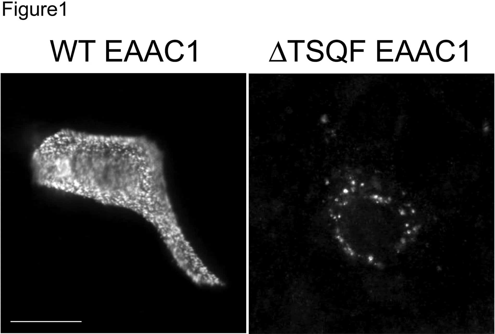 Immunofluorescence. MDCK cells were stably transfected with the indicated GFP-EAAC1 mutant transporters, fixed and analyzed by confocal microscopy. WT EAAC1 is mainly expressed at the plasma membrane, whereas ΔTSQF mutant is expressed in an endocytotic compartment. Scale bar, 10 μm