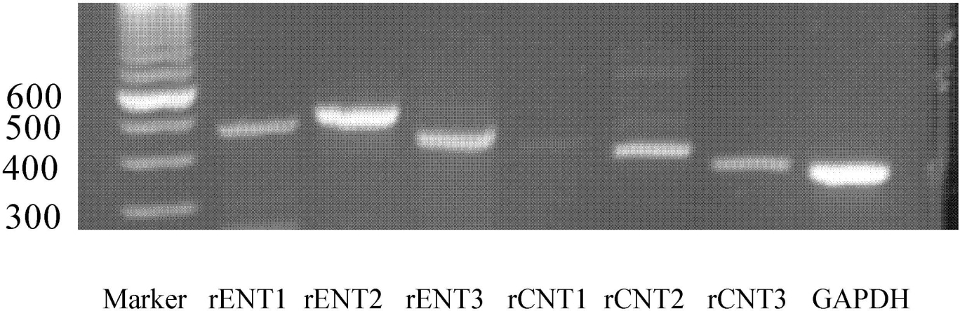 Figure 1. Expression of nucleoside transporters in rat astrocytes in the primary culture. Figure shows an ethidium bromide stained gel. Primer sequences and expected sizes of products are presented in the Table 1. Negative controls including both reverse transcriptase minus samples (RT-) and water samples were negative (data not shown).