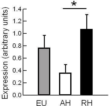 Hypothalamic IL-1B Expression