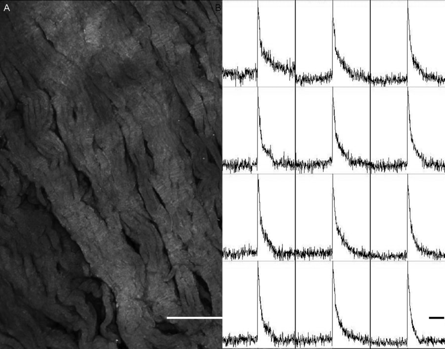 Fig. 1. Rat left ventricular tissue slice characteristics. A. Morphology shown by labelling with di-4-ANEPPS (scale bar 200 µm) B. Electrical excitability confirmed by optical mapping (scale bar 200 ms).