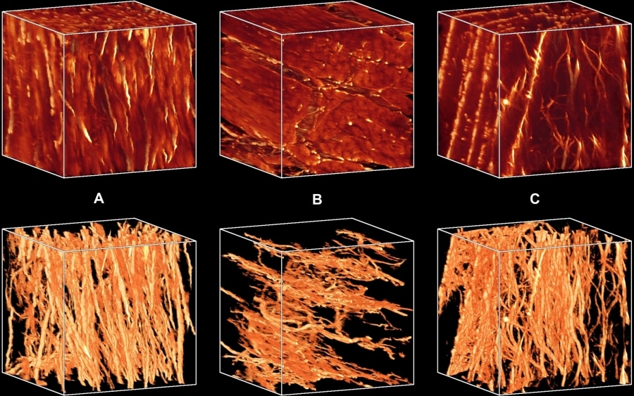 Figure 1. Sub-epicardial (A) midwall (B) and sub-endocardial (C) blocks showing myocytes and collagen (top) and collagen only (bottom). Block dimensions are 300 µm at 1.22 µm resolution.