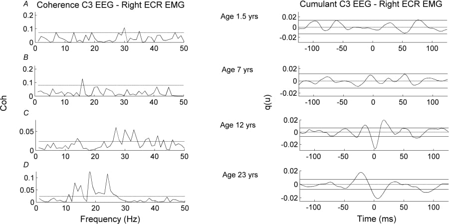 Coherence and cumulant between left motor cortex EEG and right forarm extensor EMG in 4 subjects of different ages. The data show the emergence in the older subjects of ~20 Hz coherence with associated triphasic cumulant.