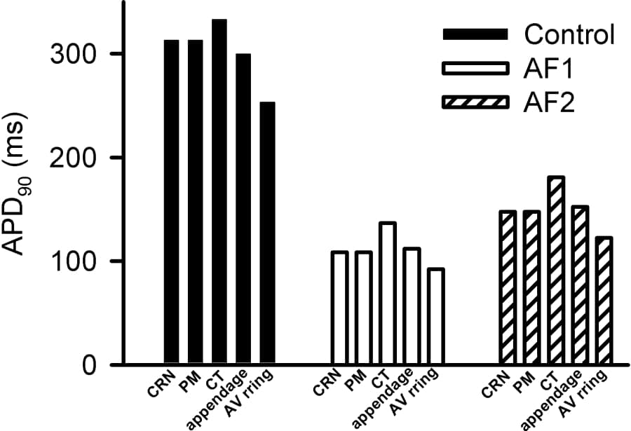 Figure 1. APD90 heterogeneity in human atrium and the effects of AF on APD90. Data shows APD90 for atrial chambers (CRN) PM CT appendage and AV ring under Control (solid bars) AF1 (empty bars) and AF2 (striped bars) conditions. The average APD90 reductions were 65% due to AF1 and 52% due to AF2.