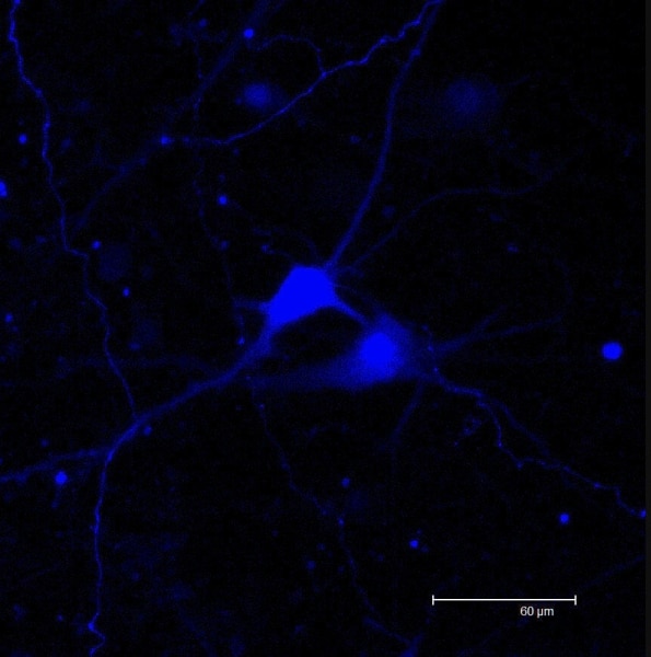 NAergic neurones expressing DsRed2 in rat organotypic brainstem slice culture. Image width: 275 μm.