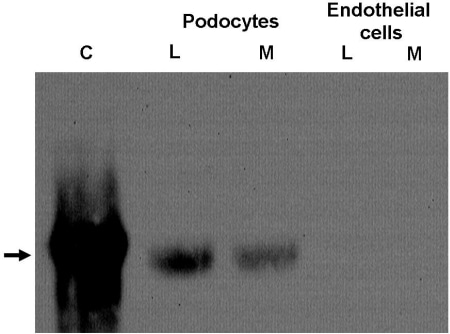 Fig.1 Analysis of adiponectin levels by Western blot of cell lysates (L) and culture media (M) from glomerular podocytes and endothelial cells. Position of adiponectin shown by arrow. C corresponds to a lane run using recombinant adiponectin as a control.