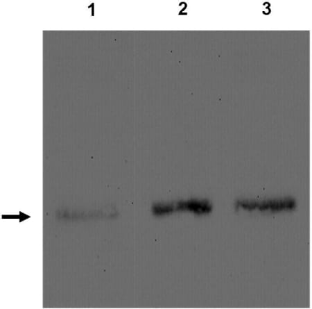 Fig 2. Analysis of adiponectin levels byWestern blot of podocyte cell lysates grown in the presence (1) or absence of insulin for 24 (2) or 48 hours (3). Position of adiponectin shown by an arrow.
