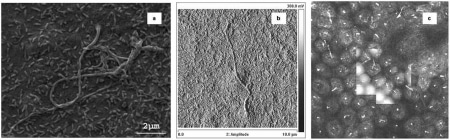 (a) SEM image (2 μm) of primary cilia on fixed MDCK cells; (b) AFM image (10 μm) of primary cilia on fixed MDCK cells; and (c) Combined confocal (immunofluorescence for tubulin and actin) and AFM images the latter present as an overlay in the centre of the confocal image.