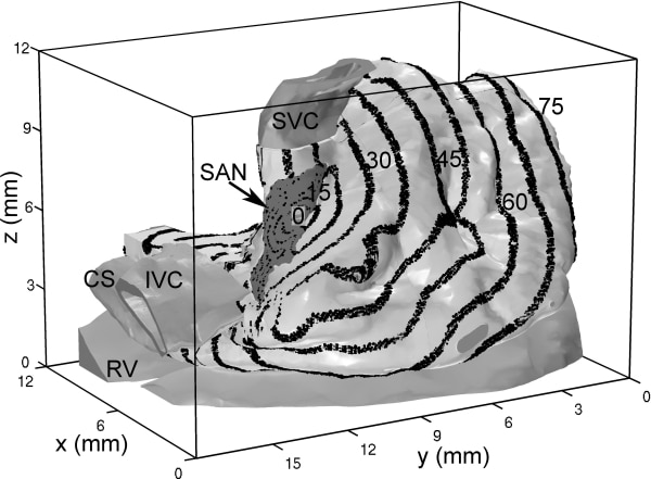 Figure 1. The propagation sequence of the action potential through the 3D right atrium. Isochrones are shown at 7.5 ms intervals.