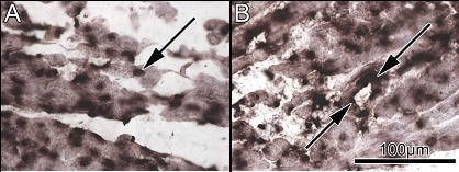 Figure 1. A, P2X5 mRNA expression in the sinoatrial node. B, P2X5 mRNA expression in the atrial muscle of the crista terminalis.