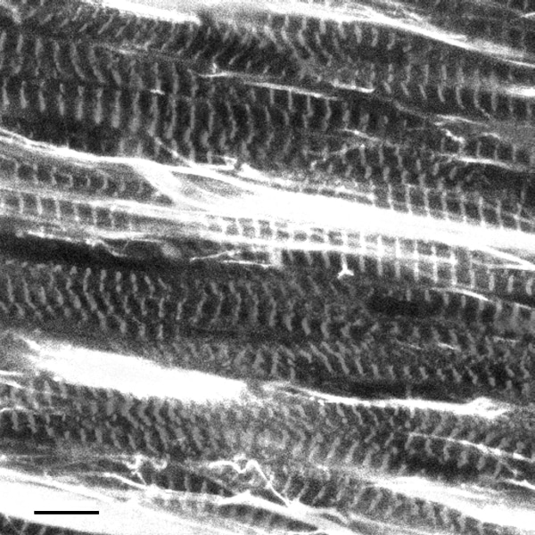 Figure 1: Confocal micrograph of rabbit right atrial myocardium, immunohistochemically labelled for cardiomyocytes (myomesin label, giving rise to striated cell appearance) and fibroblasts (vimentin, revealing brightly stained cell sheets between myocytes). Scale bar 10 μm.