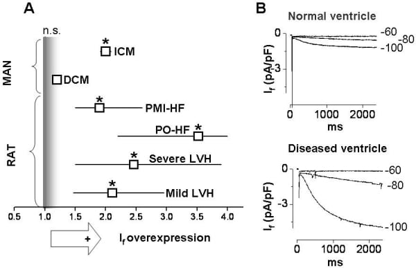 Figure 1. Ventricular If expression is increased in cardiomyopathies.