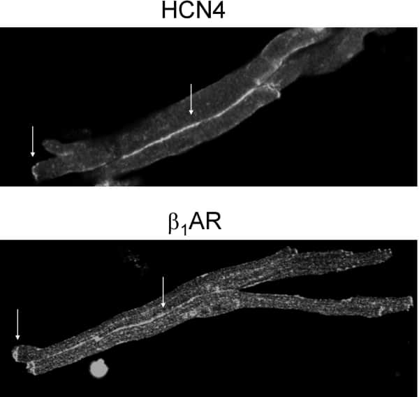 Figure 1. Pairs of sinoatrial myocytes labeled with anti-HCN4 (top) or anti-β1AR (bottom) primary antibodies and an Alexa488-conjugated secondary antibody. Arrows indicate immunofluorescence at the ends of myocytes and at the interface between the cells.