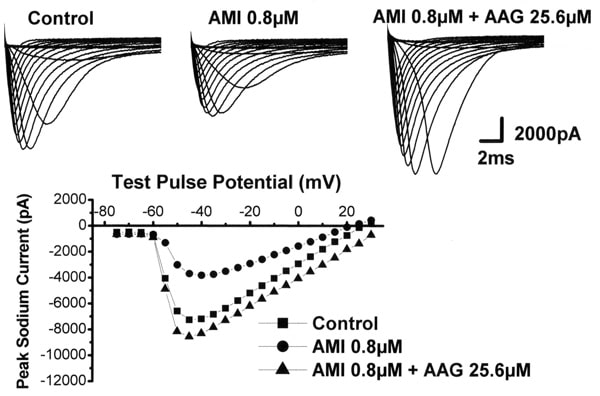 Fig1. The effect of amitriptyline and amitriptyline (AMI) plus AAG on sodium channels recorded in modified physiological solution. INa was elicited by a 20 ms depolarisation to test potentials between -75mV and 30mV from a potential of -90mV. INa under control AMI and AMI plus AAG are shown in the top panel. The peak value of the currents is plotted against the test pulse potentials below. The keys indicate drug concentrations applied.