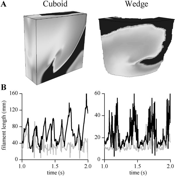 A Snapshots of orthotropic re-entrant excitation in the cuboid and wedge models after 2 s of activity. Dark is resting tissue light is excited. The scroll waves are rotating clockwise. B Filament length during 1 s of activity in the two geometries for anisotropic (grey) and orthotropic (black) architectures.