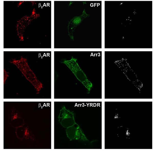 Arrestin-3 promotes cell surface targeting of the β2AR while the arrestin-3 YRDR mutant retains the receptor intracellularly. HEK293 cells were co-transfected with pcDNA3-HA-β2AR and either pEGFP-N1 pEGFP-N1-arrestin-3 or pEGFP-N1-arrestin-3 YRDR. The cells were processed for confocal microscopy. Co-localizing pixels were extracted by scatter plots and shown in the right panel.