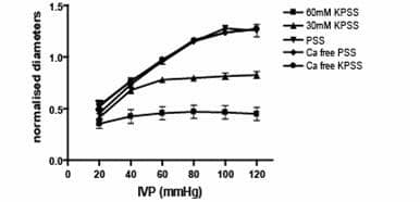 The response of isolated pressurised arteries from non-pregnant rats to changes in IVP.