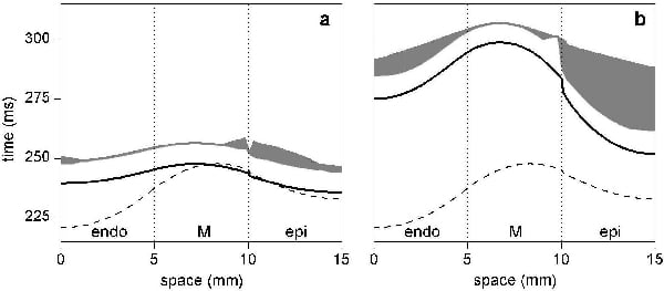 Figure 1. Transmural dispersion of APD90 (solid line) and spatio-temporal extent of the VW (grey area) in the 1D canine ventricular strand: (a) amiodarone and (b) d-sotalol; dispersion of APD90 in control is shown by dashed lines. The effect of d-sotalol is modelled by depressing IKr by 50% in endo- by 70% in M- and by 20% in the epicardial cells; the effect of amiodarone is modelled by depressing IKs by 80% in endo- and by 30% in epicardial cells and depressing INa1 by 80% in M-cells.
