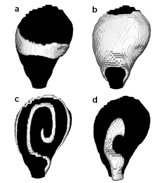 Figure 1. Anterior view of computed excitation wave patterns on gravid uterus white is excitation. a (D= 0.03) b (D=0.16) solitary circular waves initiated at the fundus; c pair of re-entrant spiral waves (0.01) and d (D=0.05) solitary broken wave pinned to the cervix.