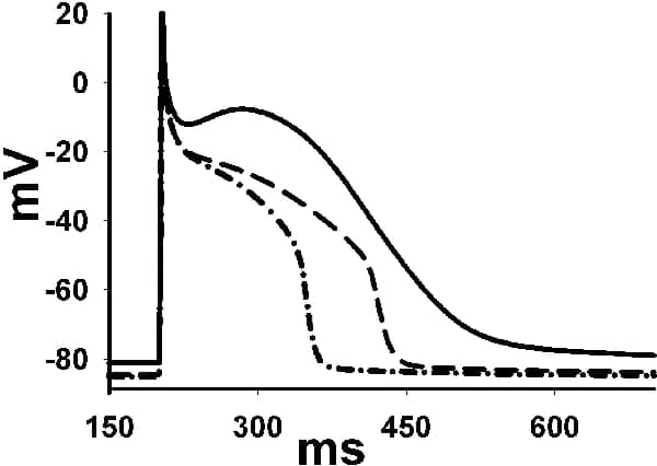 Figure 1. Changes in APD due to gain-of-function in IK1. WT AP profile is shown as solid line (APD = 322.73 ms) HMT as dashed line (APD = 257.7 ms) and the MT as dashed-dotted line (APD = 225.68 ms). The APD decreased by 20.67 % in HMT case and by 30.24 % in the MT case. Changes in APD associated with gain-of-function in IK1 are not available.