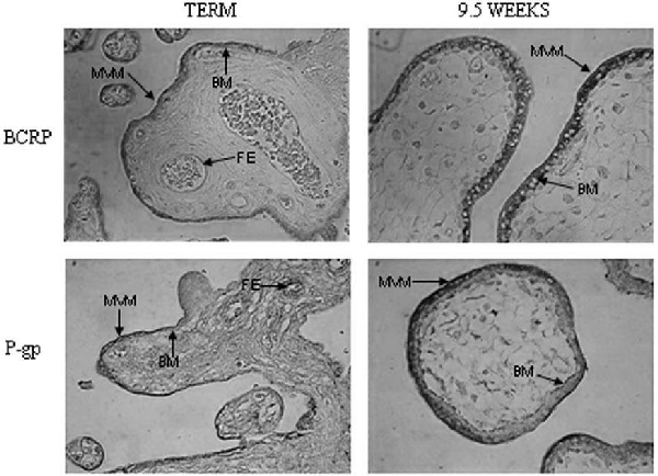 Figure 1. Expression and localization of BCRP (BXP-21) and P-gp (F4) in human placenta at term (representative of 4 samples) and 9 weeks gestation. A similar distribution is seen in all first trimester samples (magx400 MVM-microvillous membrane BM-basal membrane FE-fetal endothelium).