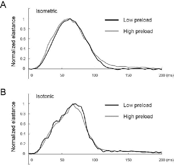 Figure 1. Pre- and afterload-dependent morphological changes in elastance curve.