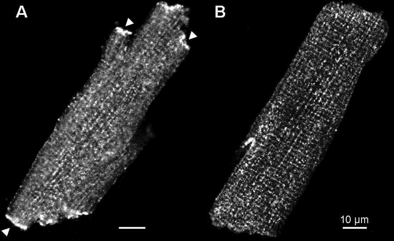 Figure 1. The effect of two different fixation treatments on immunolabelling of Kv1.5. A strong labelling at intercalated discs (e.g. at arrow) with MeOH fixation. B weak striated pattern of labelling with PFA fixation. Using a different Kv1.5 antibody and MeOH fixation strong labelling of Kv1.5 at the intercalated disc was previously observed in rat ventricular myocytes (Dobrzynski et al. 2000).