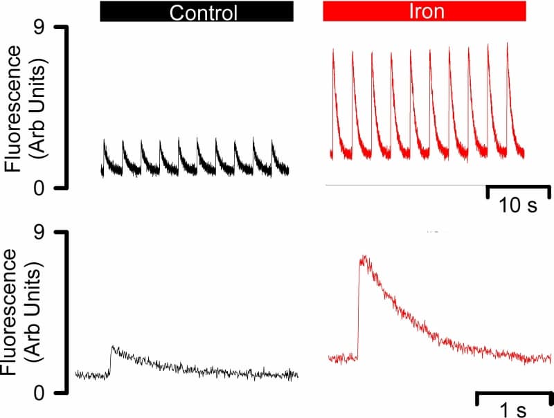 Figure 1. Effects of acute iron exposure on the systolic Ca transient. Original data show: top systolic Ca transients in response to electrical stimulation every 0.33 Hz in control (left) and iron (right). Bottom average systolic Ca transients taken from the data shown above in control (left) and in iron (right).