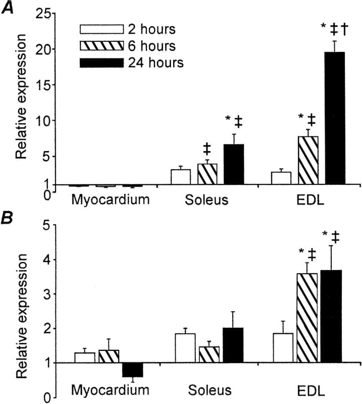 Figure 1. Fold changes in A) MuRF1 and B) MAFbx mRNA expression from corresponding control value in myocardium soleus and EDL muscles in response to LPS. Values represent mean Â± S.E. â€¡ Indicates different from corresponding control (P<0.05 MANOVA); * different from 2 hour LPS-treated muscle (P<0.05 MANOVA LSD post-hoc); â€  different from 6 hour LPS-treated muscle (P<0.05 MANOVA LSD post-hoc).