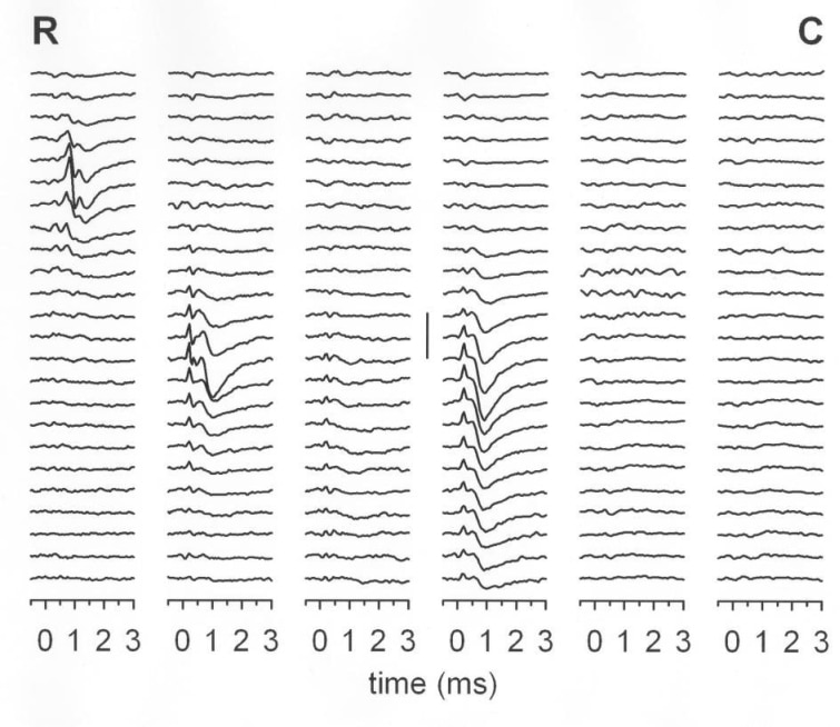 Figure 1. Example of averaged FSPs recorded from 6 electrodes (vertical columns) spaced at 2mm intervals. Traces start at 2.3 mm below the surface and are spaced at 50 µm depths. Vertical scale bar = 20 µV. R – rostral, C – caudal.