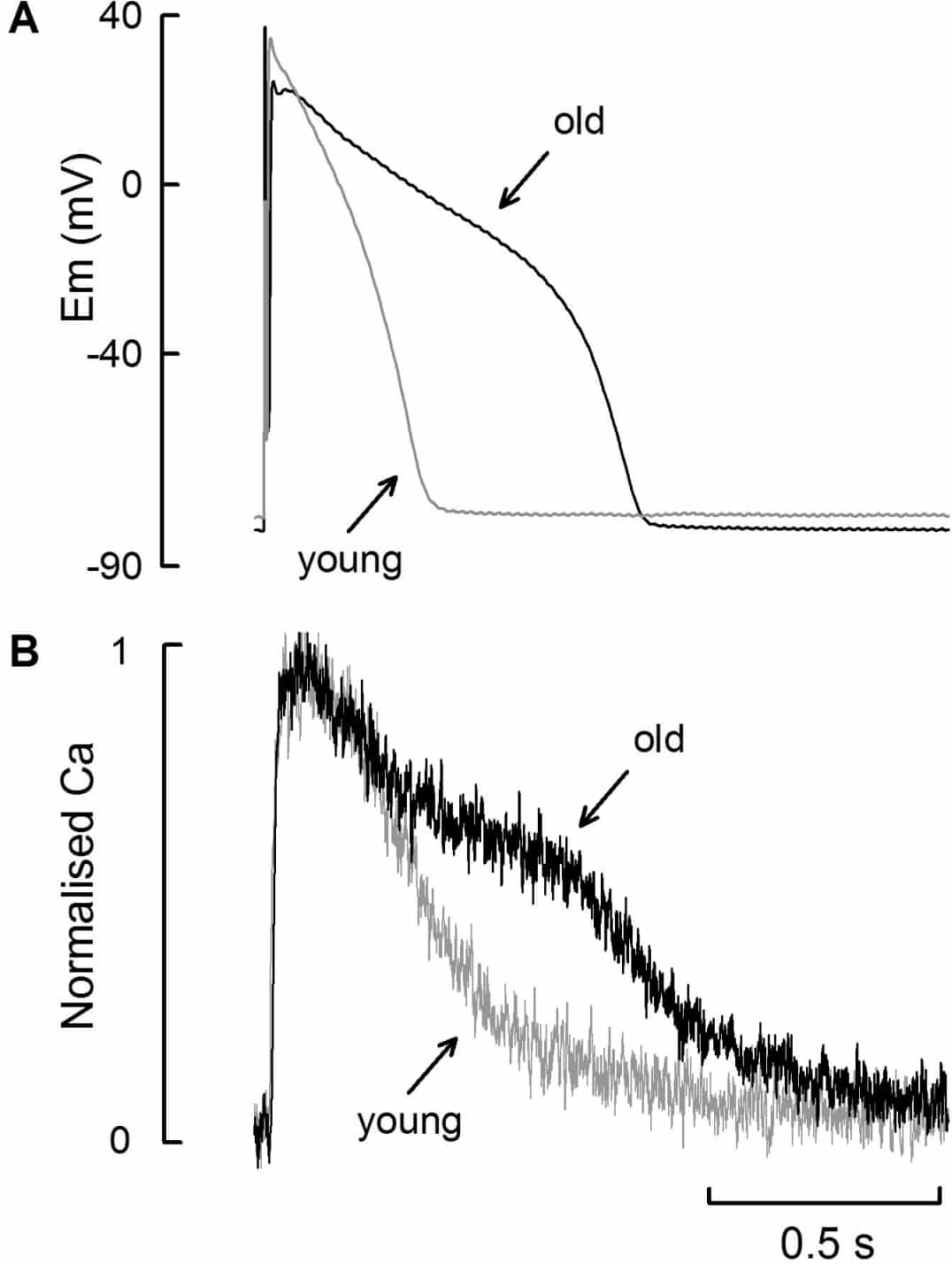 Figure 1. A,representative action potentials in myocytes isolated from young (grey) and old (black) animals at 37°C. B,normalised Ca transients associated with the action potentials shown in panel A.
