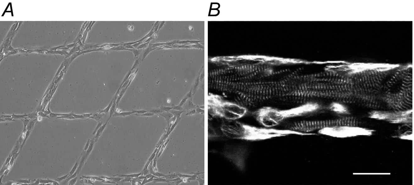 Figure 1. A, 2D micro-patterned neonatal rat myocytes (line width 28 µm). B, cell type identification by immunolabelling for myomesin (striated pattern – myocytes) and vimentin (bright full cells – fibroblasts). Scale bar: 20 µm.