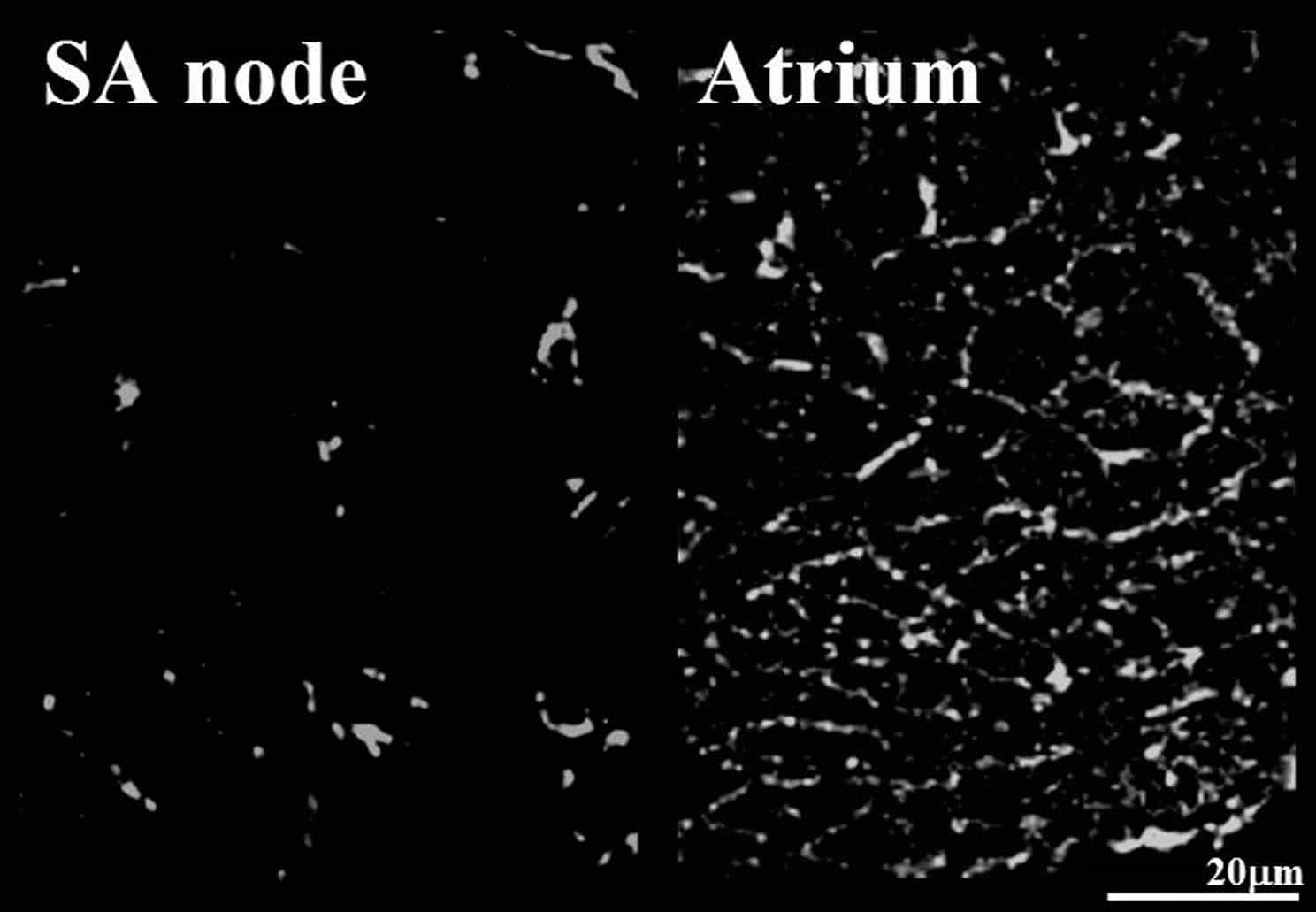 Figure 1. Expression of Cav1.2 protein. Punctate labellingwas observed around the outer membrane of atrial cells, butwas absent from the centre of the SA node.