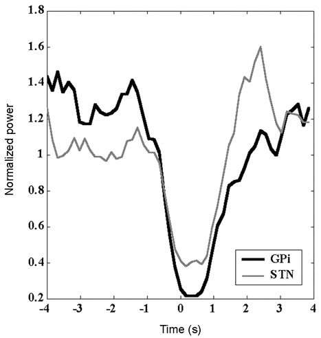 \"Figure 1. The 27 Hz (high beta) ERD for GPi and STN, averaged over 150 trials. Zero on the x-axis is the EMG burst onset.\"