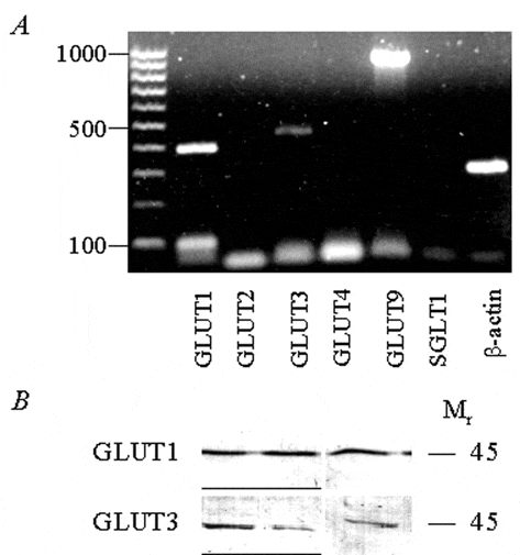 \"Figure 1. A, PCR evidence for expression of GLUT1, GLUT3 and GLUT9 and the absence of GLUT2, GLUT4 and SGLT1 in human articular cartilage. B, immunoblots of GLUT1 and GLUT3 expressed in monolayer cultured human chondrocyte-like cells. Total chondrocyte membranes (50 µg in each of the three lanes shown) were analysed for GLUT1 and GLUT3 content by use of specific polyclonal antisera. Mr, relative molecular weight.\"