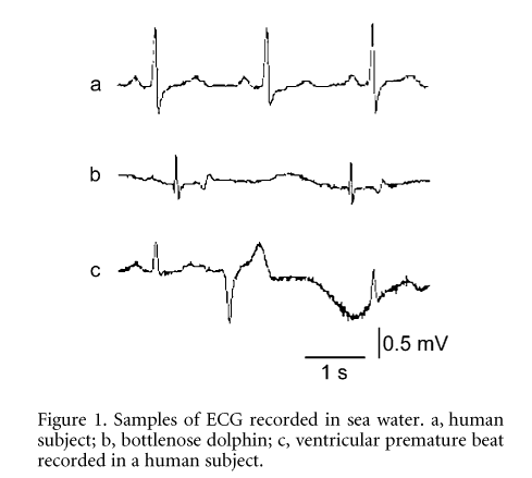 \"Figure 1. Samples of ECG recorded in sea water. a, human subject; b, bottlenose dolphin; c, ventricular premature beat recorded in a human subject.\"