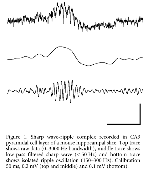 Figure 1. Sharp wave-ripple complex recorded in CA3 pyramidal cell layer of a mouse hippocampal slice. Top trace shows raw data (0-3000 Hz bandwidth), middle trace shows low-pass filtered sharp wave (< 50 Hz) and bottom trace shows isolated ripple oscillation (150-300 Hz). Calibration 50 ms, 0.2 mV (top and middle) and 0.1 mV (bottom).\"