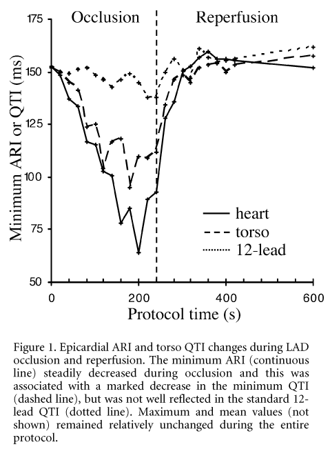 Figure 1. Epicardial ARI and torso QTI changes during LAD occlusion and reperfusion. The minimum ARI (continuous line) steadily decreased during occlusion and this was associated with a marked decrease in the minimum QTI (dashed line), but was not well reflected in the standard 12-lead QTI (dotted line). Maximum and mean values (not shown) remained relatively unchanged during the entire protocol.\"