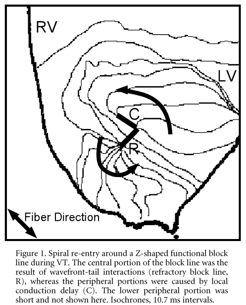Figure 1. Spiral re-entry around a Z-shaped functional block line during VT. The central portion of the block line was the result of wavefront-tail interactions (refractory block line, R), whereas the peripheral portions were caused by local conduction delay (C). The lower peripheral portion was short and not shown here. Isochrones, 10.7 ms intervals.\"
