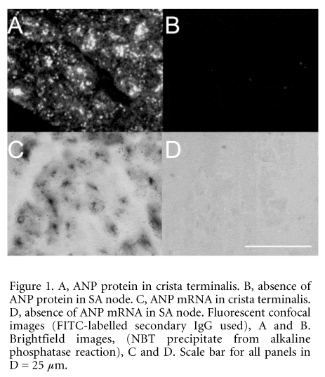 Figure 1. A, ANP protein in crista terminalis. B, absence of ANP protein in SA node. C, ANP mRNA in crista terminalis. D, absence of ANP mRNA in SA node. Fluorescent confocal images (FITC-labelled secondary IgG used), A and B. Brightfield images, (NBT precipitate from alkaline phosphatase reaction), C and D. Scale bar for all panels in D = 25 mm.\"